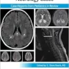 Pediatric Collections: Neurology Cases: Case Reports From Pediatrics In Review (PDF)