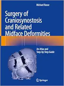 Surgery Of Craniosynostosis And Related Midface Deformities: An Atlas And Step-By-Step Guide, 2024th Edition (PDF)