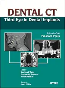 Dental CT: Third Eye In Dental Implants (PDF)