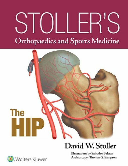 Stoller’s Orthopaedics And Sports Medicine: The Hip (PDF)