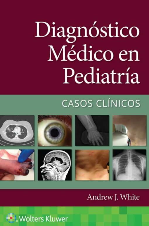 Diagnóstico Médico En Pediatría. Casos Clínicos (PDF)