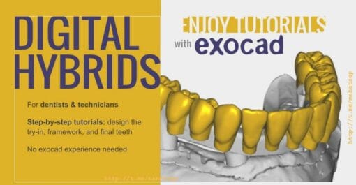 Digital Hybrids for Dentists and Technicians Enjoy Tutorials with Exocad