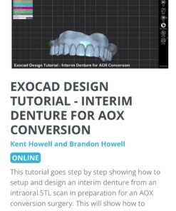 Interim Digital Denture: Every Step!!