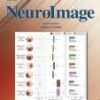 NeuroImage PDF