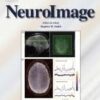 NeuroImage PDF