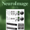 NeuroImage PDF