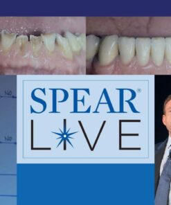 Spear : The Art of Treatment Planning and Case Presentation