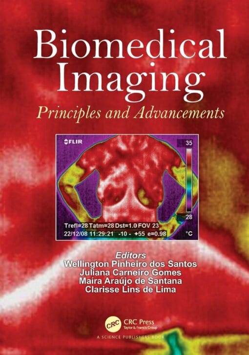 Biomedical Imaging: Principles And Advancements (PDF)