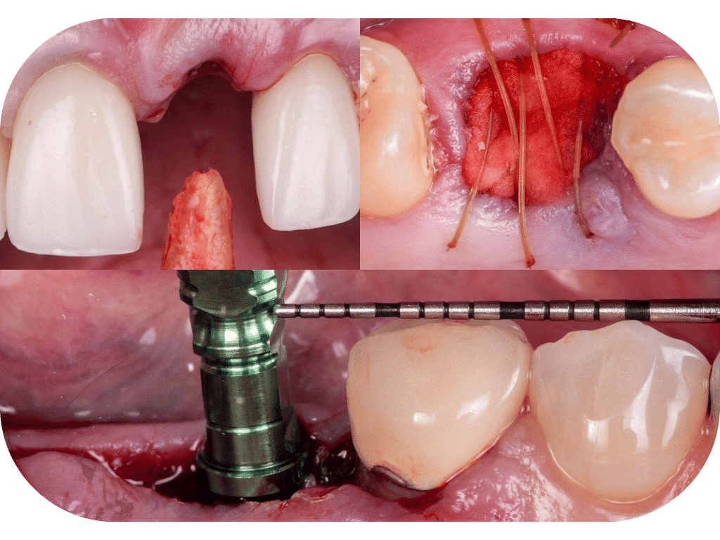 10 Essential Fundamentals of Implant Dentistry: 2024 Comprehensive Guide