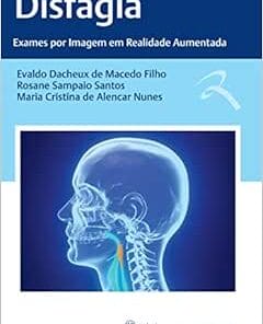 Disfagia: Exames Por Imagem Em Realidade Aumentada (EPUB)