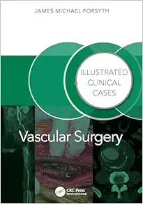 Vascular Surgery: Illustrated Clinical Cases (PDF)