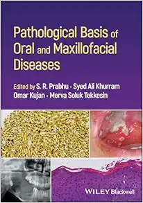 Pathological Basis Of Oral And Maxillofacial Diseases (PDF)