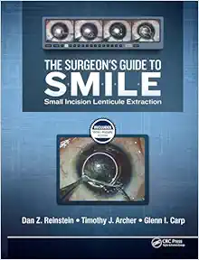 The Surgeon’s Guide To SMILE: Small Incision Lenticule Extraction (Videos)