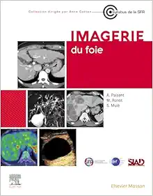 Imagerie Du Foie (French Edition) (PDF)