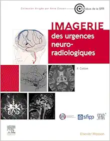 Imagerie Des Urgences Neuroradiologiques (PDF)