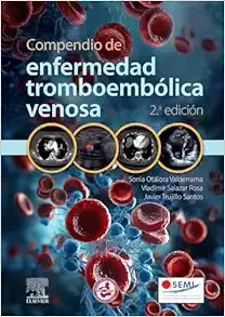 Compendio De Enfermedad Tromboembólica Venosa, 2.ª Edición (PDF)