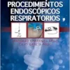 Manual De Sedación Para Procedimientos Endoscópicos Respiratorios (PDF)