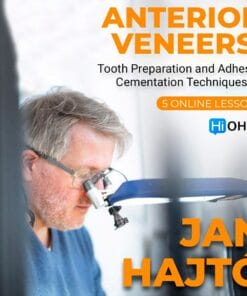 Precision in Laminate Ceramic Veneers: Tooth Preparation and Adhesive Cementation Techniques