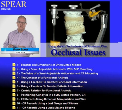 SPEAR Using Models To Evaluate and Treatment Plan Occlusal Issues – Frank Spear