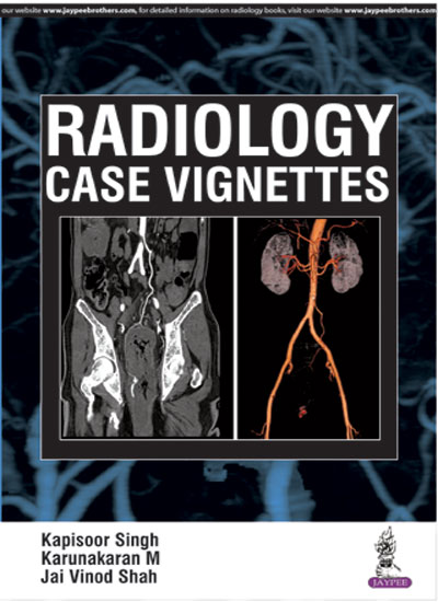 Discover the Best Free Radiology Books Available Online: 2024 Complete Guide