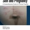 Skin And Pregnancy: A Comprehensive Guide For Clinical Practice (PDF)