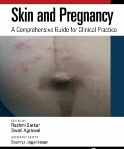 Skin And Pregnancy: A Comprehensive Guide For Clinical Practice (PDF)