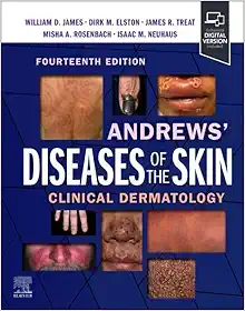 Andrews’ Diseases Of The Skin: Clinical Dermatology, 14th Edition (EPUB)