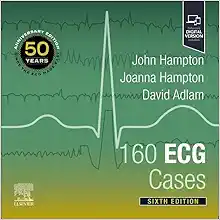 160 ECG Cases, 6th Edition (EPUB)