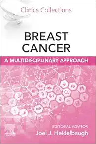 Breast Cancer: A Multidisciplinary Approach (Clinics Collections, Volume 14 -1) (PDF)