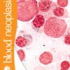 Blood Neoplasia PDF