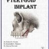 PTERYGOID IMPLANT PDF