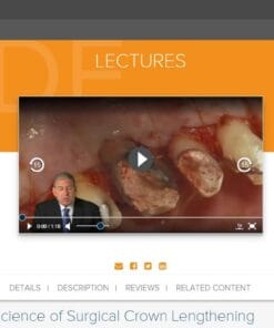 gIDE ondemand lectures – The Art and Science of Surgical Crown Lengthening  