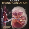 Textbook Of Kidney Transplantation (PDF)