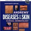 Andrews’ Diseases Of The Skin: Clinical Dermatology, 14th Edition (PDF)