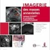 Imagerie Des Masses Annexielles: Lexique O-RADS Et Corrélations Radiopathologiques (PDF)