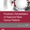 Prosthetic Rehabilitation Of Head And Neck Cancer Patients (EPUB)