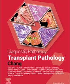 Diagnostic Pathology: Transplant Pathology, 3rd Edition (EPUB)