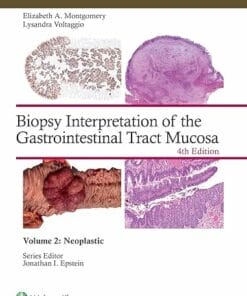 Biopsy Interpretation of the Gastrointestinal Tract Mucosa Volume 2: Neoplastic: eBook without Multimedia (Biopsy Interpretation Series) 4th edition (EPUB)